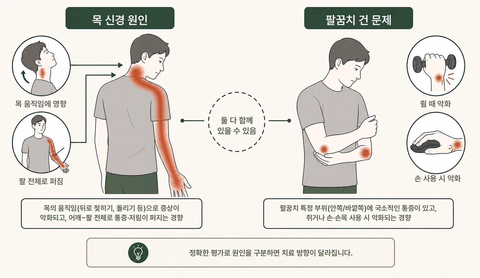 목 디스크와 팔꿈치 통증은 어떻게 구분하나요? 설명 이미지