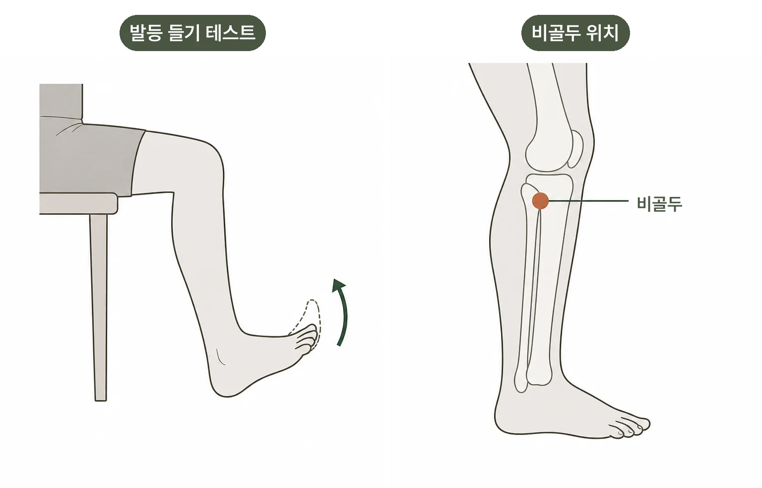 발이 처지는데 반드시 허리 디스크일까요? 설명 이미지
