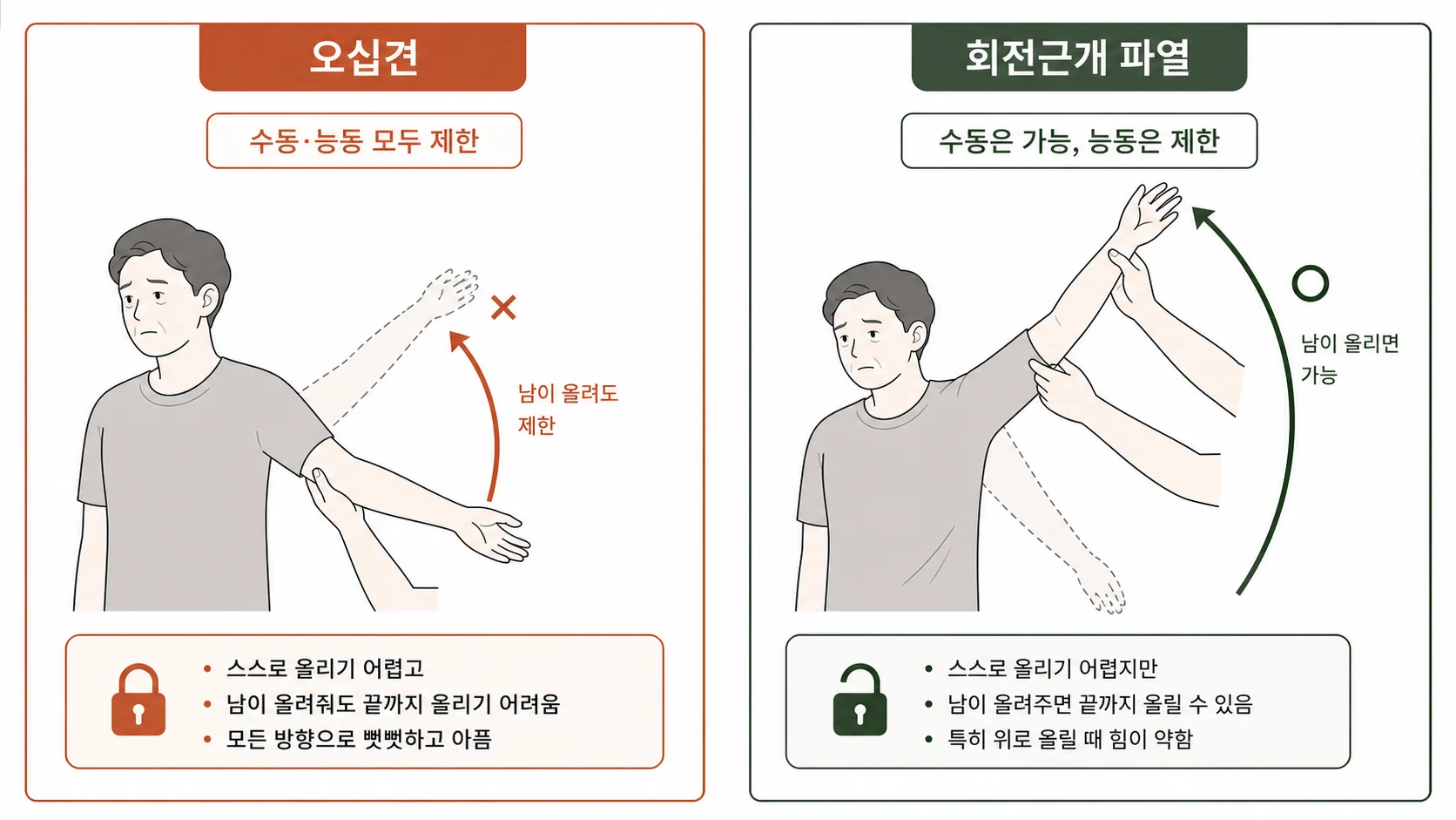 오십견과 회전근개 파열, 어떻게 다른가요? 설명 이미지