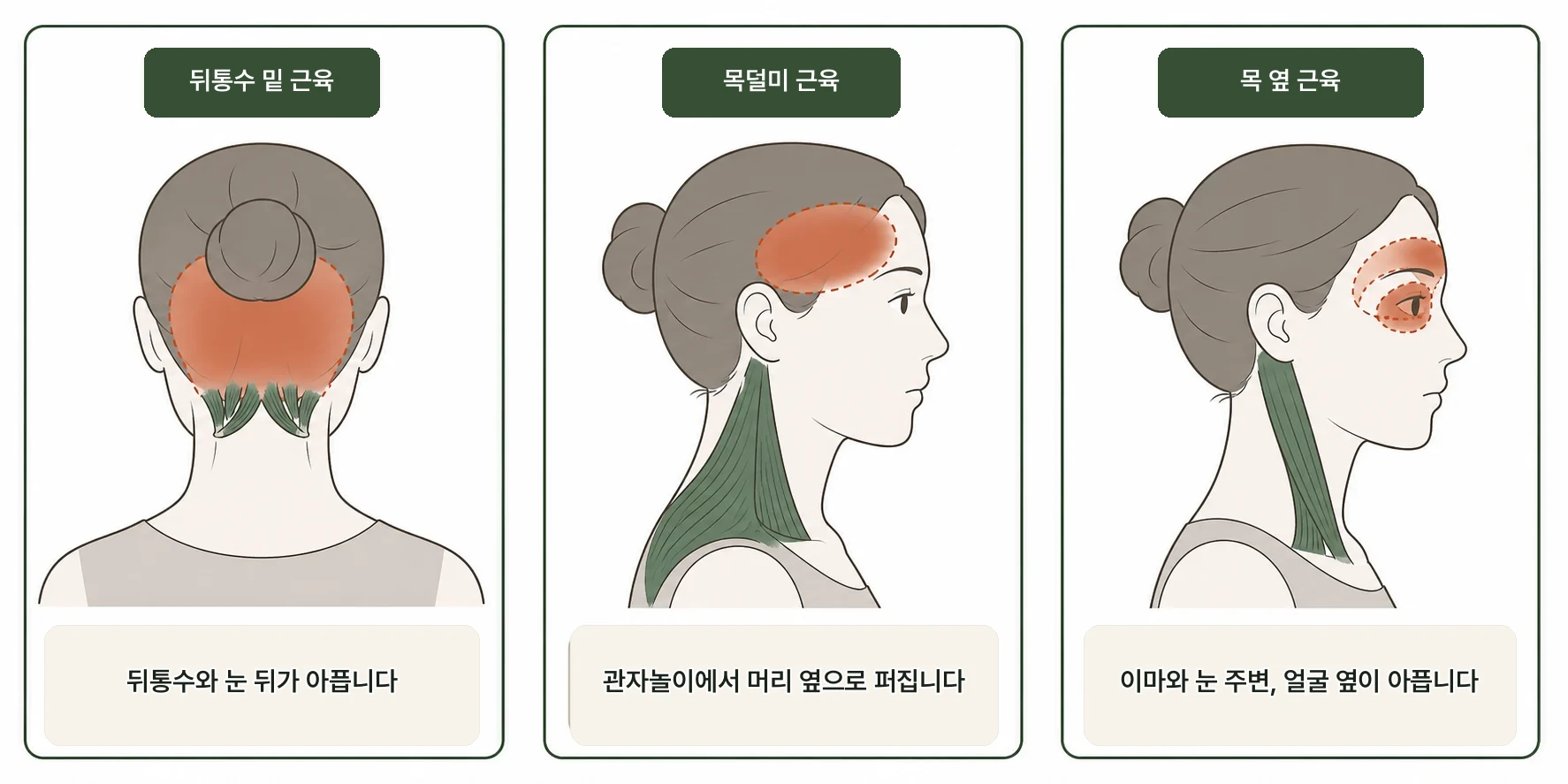 갱년기 두통이 목 근육과 관련이 있나요? 설명 이미지