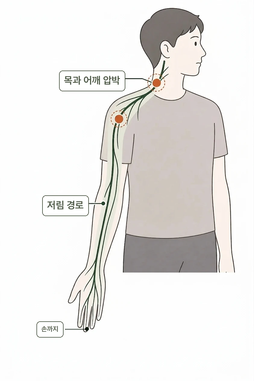 어깨에서 팔까지 저려요 설명 이미지