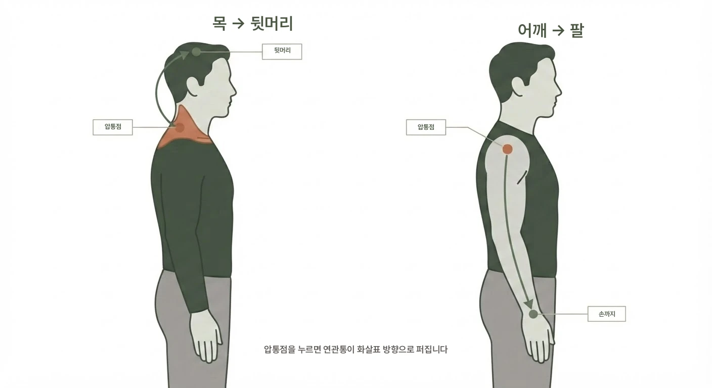 누르면 딴 곳까지 아픈 이유 설명 이미지