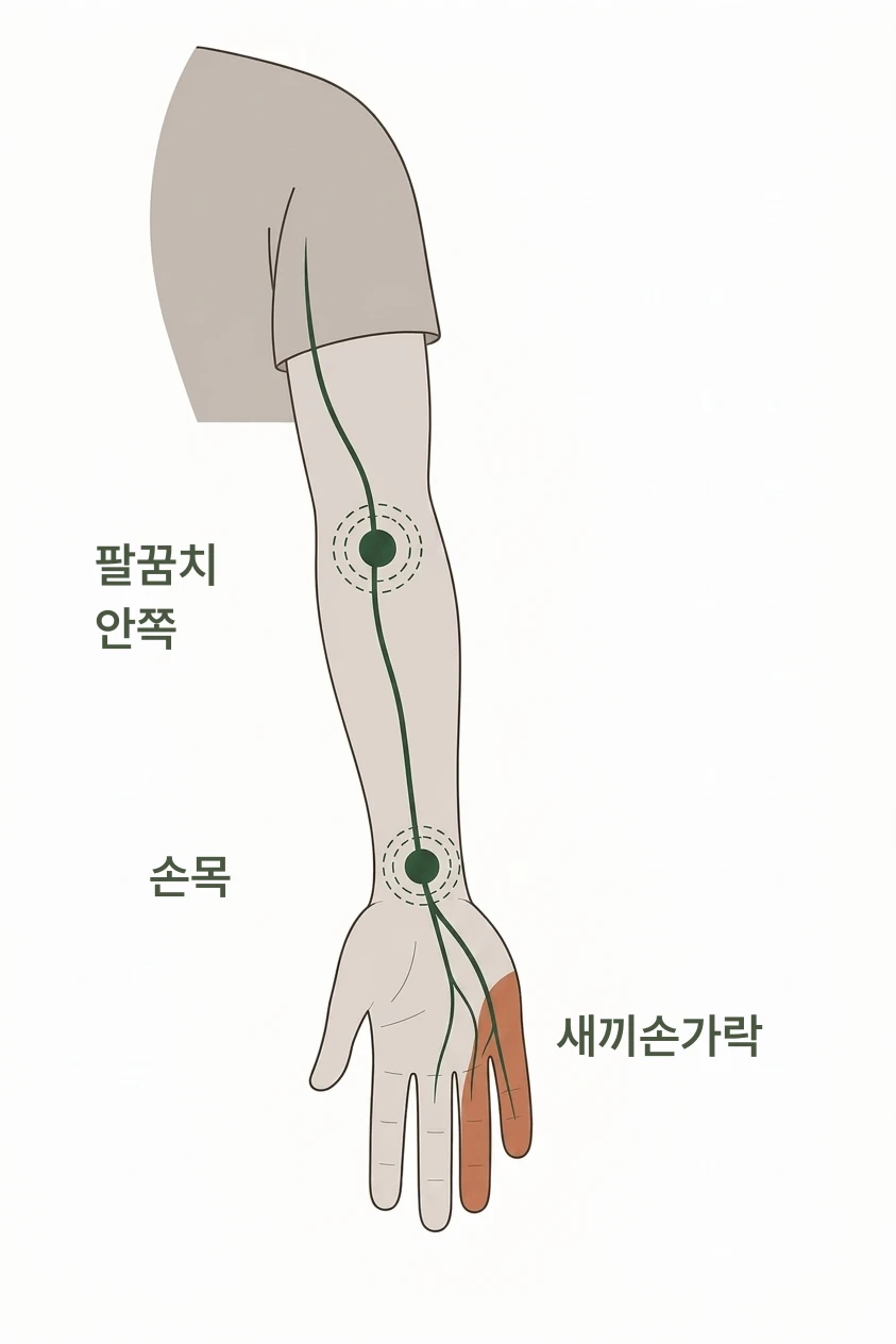 사무직에서 새끼손가락이 저리는 이유는? 설명 이미지