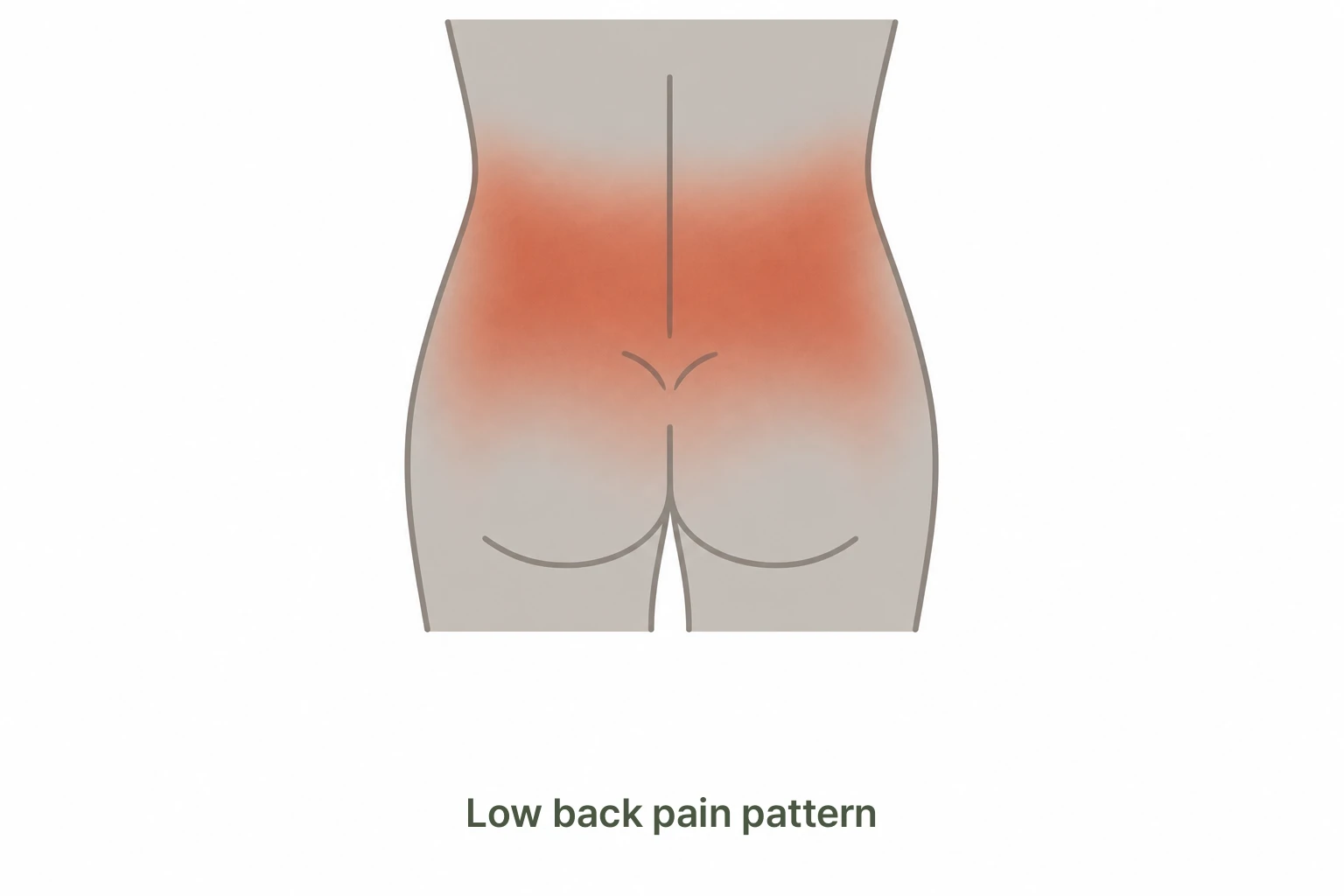 Illustration showing back pain locations