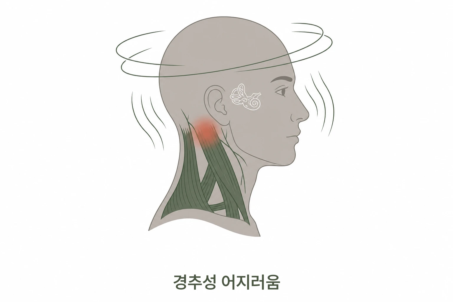 경추성 어지러움과 목 근육 연관 일러스트