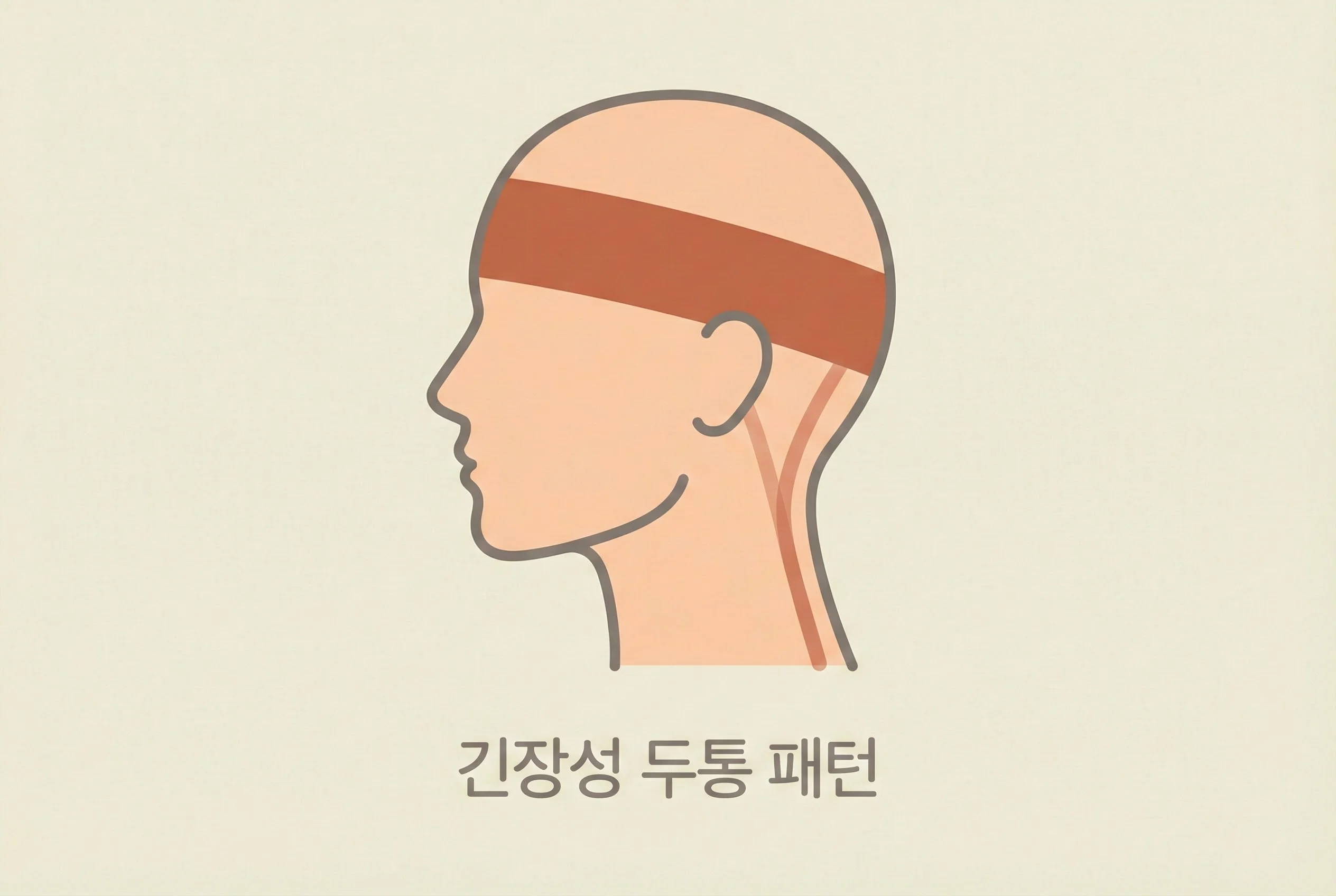 긴장성 두통 부위 표시 일러스트