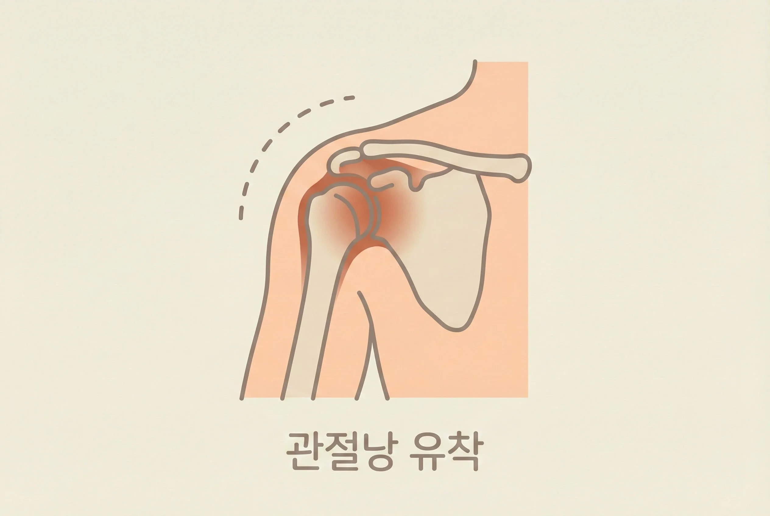 오십견 어깨 관절낭 일러스트